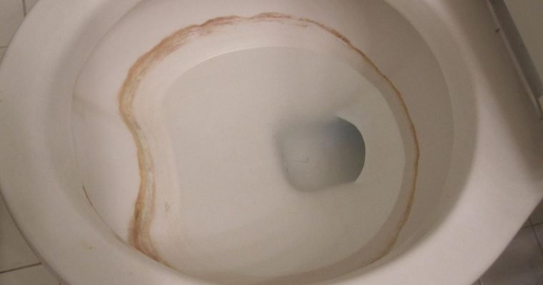 Why You Shouldn’t Use Drano in Toilets – Do This Instead