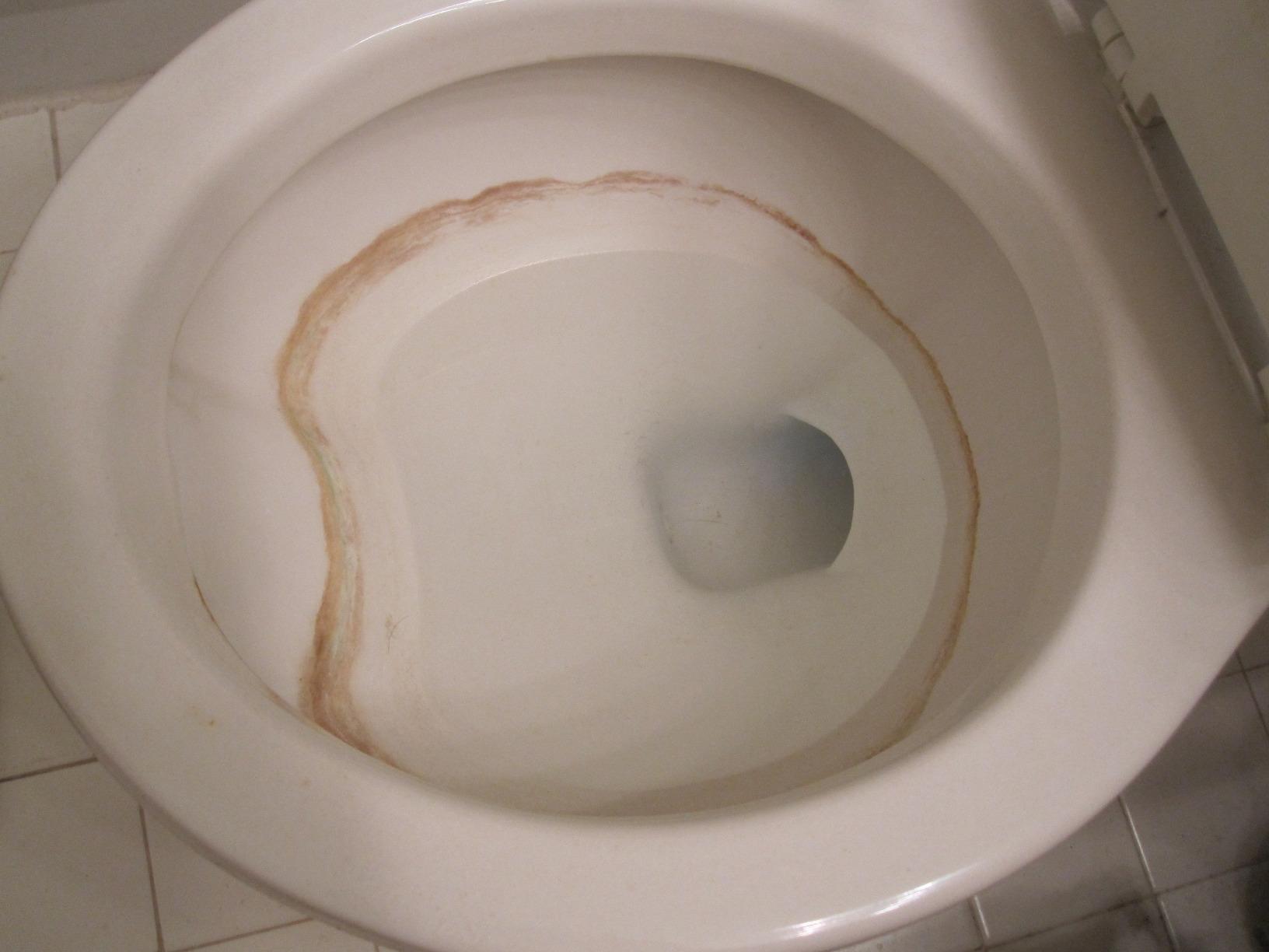 This is Why You Shouldn't Use Drano in Your Toilet 