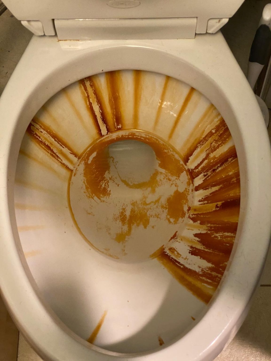 How To Remove Brown Water Stain From Toilet Bowl