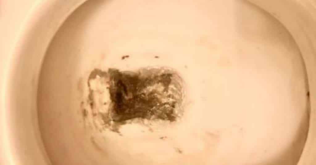 black-stains-in-a-toilet bowl